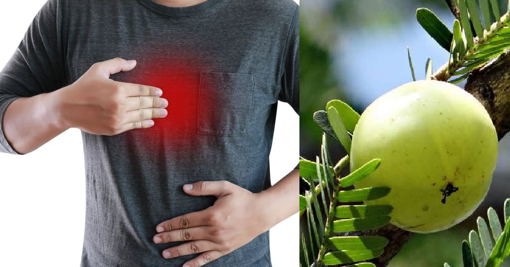 एसिडिट से है परेशान तो अपनाएं यह घेरलु नुस्खा, तुरंत मिलेगी राहत