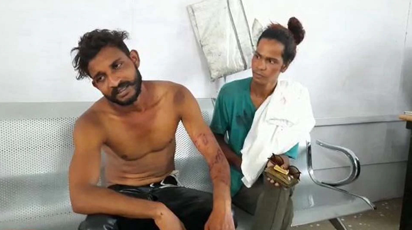 किन्नर के प्यार में इस कदर पागल हुआ मध्यप्रदेश का युवक की प्यार दिखाने के लिए काट डाला खुद का हाँथ...