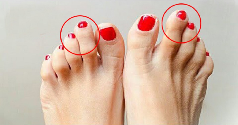 महिलाओं के पैर की उंगली से जाने कैसा है स्वभाव, पढ़िए पूरी खबर