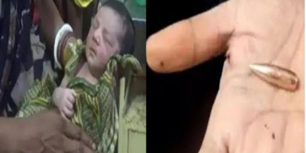 रिवाल्वर की गोली लेकर पैदा हुआ बच्चा, मां सहित डॉ के उड़ गए होश, कहानी पढ़ कर रह जाऐगें सन्न....