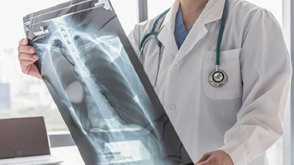 OMG: महिला को हमेशा रहता था छाती में दर्द, इलाज कराने गई तो फेफड़े से निकला Condom, मचा हड़कंप