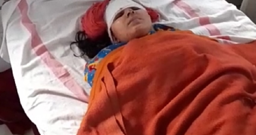 तलवार से हमला कर भाई ने बहन का काटा हाथ