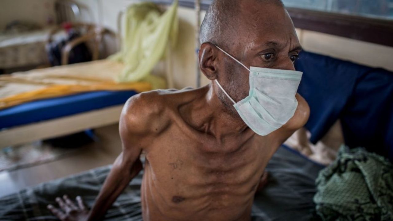 महामारियों के महासमुद्र में है विश्व, 7 ऐसी बीमारियां जो कोरोना से भी ज्यादा हैं खतरनाक, हमें रहना होगा सावधान, जाने बीमारियों के....