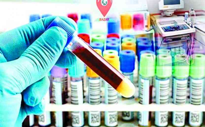 REWA : पैथालॉजी केंद्र पहुचा प्रशासन, जांच कर किया सील