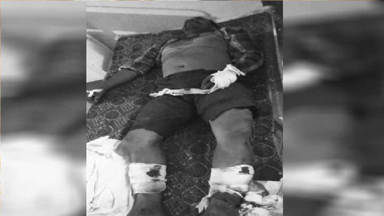 सतना में गैंगवार / पेशेवर बदमाश और उसके भाई पर हमला, एक की मौत, दूसरा गंभीर Gangwar in Satna Professional miscreant and his brother attacked by supervised criminals, one dead another serious news in hindi