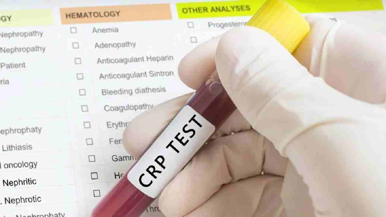 RT-PCR and CT-Scan, you must have heard a lot, now know what is CRP test and why it is necessary for corona infected ...