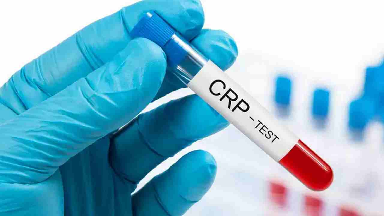 RT-PCR और CT-Scan तो आपने बहुत सुना होगा, अब जानिए क्या है CRP Test और क्यों है यह कोरोना संक्रमितों के लिए जरूरी...