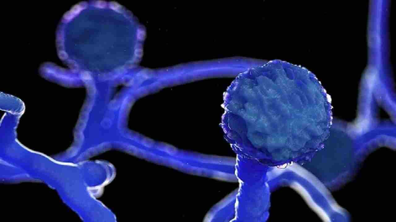 रीवा के SGMH में ढाई घंटे चला ब्लैक फंगस इन्फेक्टेड मरीज का ऑपरेशन, निकालनी पड़ी आँख और नाक से ब्लैक टिश्यू रीवा के SGMH में ढाई घंटे चला ब्लैक फंगस इन्फेक्टेड मरीज का ऑपरेशन, निकालनी पड़ी आँख और नाक से ब्लैक टिश्यू