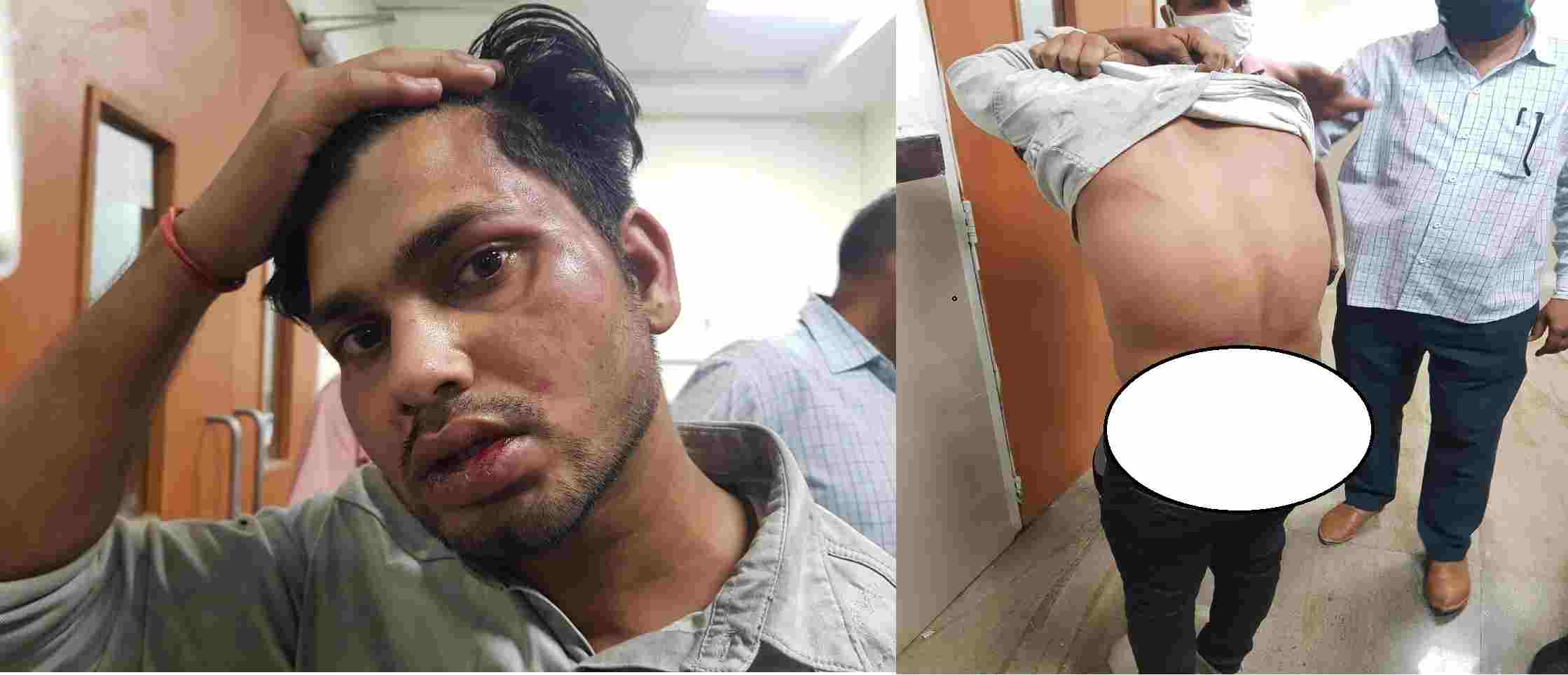 Rewa : सीआईएसएफ जवान से मारपीट के आरोप में 8 डॉक्टर सहित 4 अन्य पर एफआईआर दर्ज