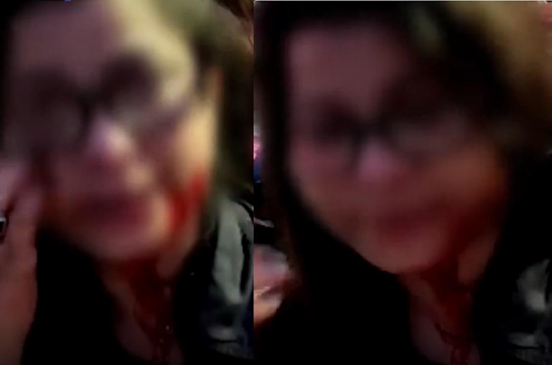 Bhopal: छात्रा पर ब्लेड से हमला, पार्टी के दौरान हुई वारदात, यह थी वजह