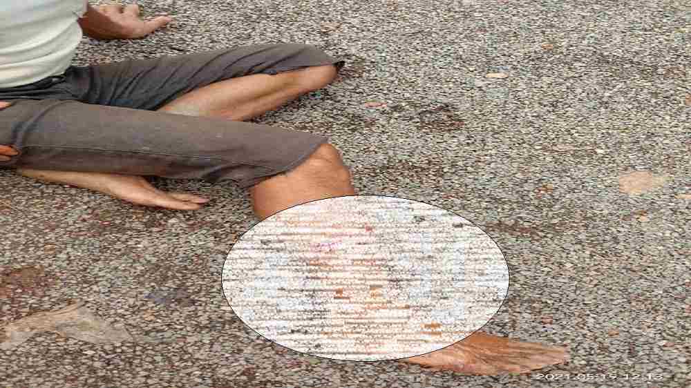 Rewa: जमीनी विवाद में टंगी-फर्से से जानलेवा हमला, 3 घायल एक SGMH रेफर Rewa: जमीनी विवाद में टंगी-फर्से से जानलेवा हमला, 3 घायल एक SGMH रेफर