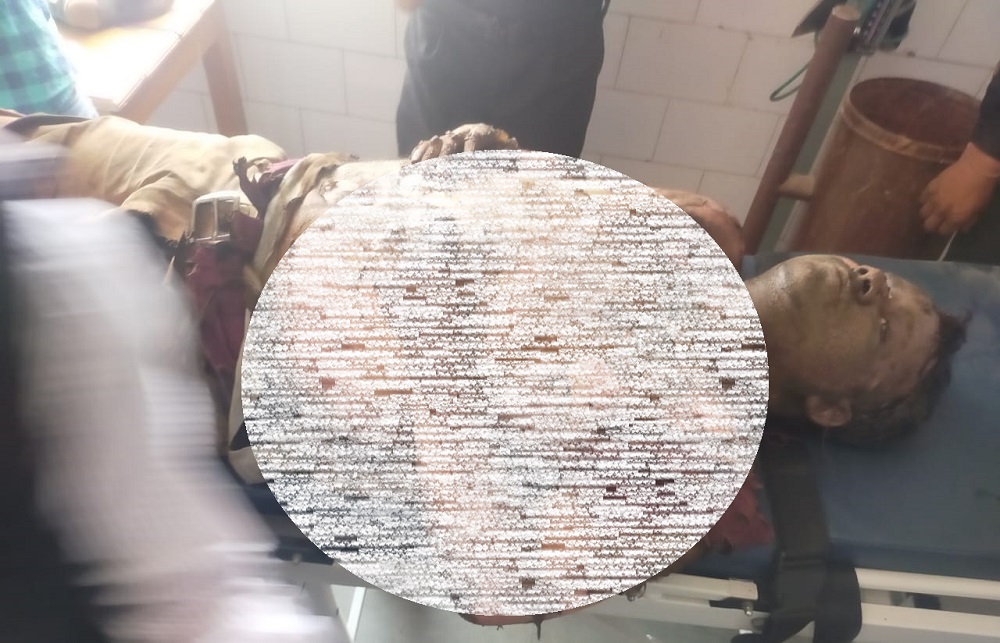 KJS CEMENT FACTORY में विस्फोट, 3 मजदूर झुलसे, JABALPUR रेफर : SATNA NEWS