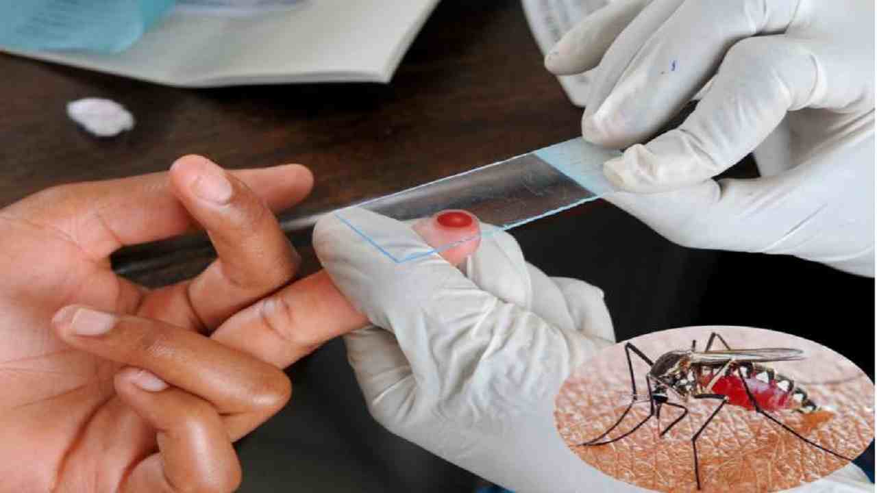 Rewa News Today : Corona के बाद तेजी से फ़ैल रही ये बीमारी, सतर्क रहने की अपील