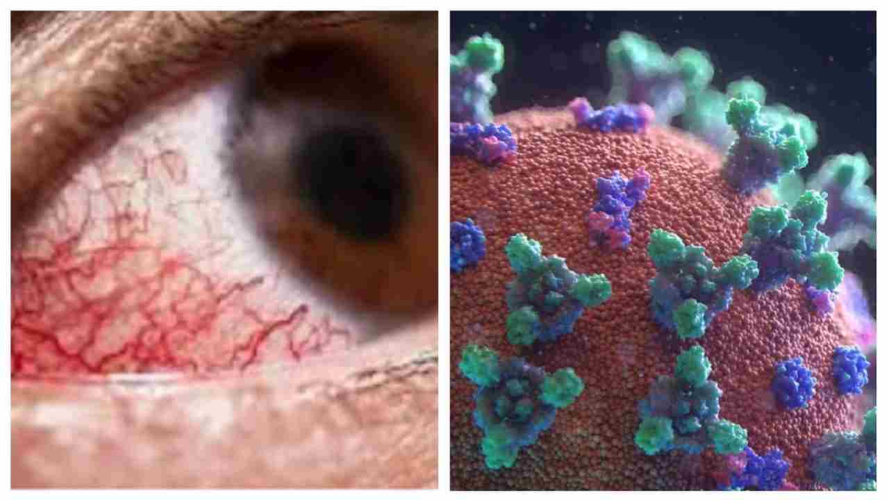 Indore-Sagar में Black Fungus इंजेक्शन से रिएक्शन, 6 कंबल डालने के बाद भी कांप रहे मरीज Indore-Sagar में Black Fungus इंजेक्शन से रिएक्शन, 6 कंबल डालने के बाद भी कांप रहे मरीज