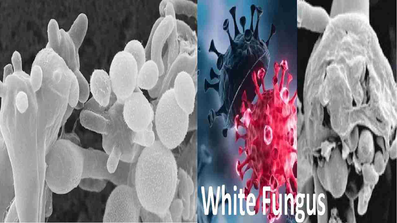 Bihar से होते हुए MP पहुंचा White Fungus, इस जिले के मरीजों में दिखे लक्षण Bihar से होते हुए MP पहुंचा White Fungus, इस जिले के मरीजों में दिखे लक्षण