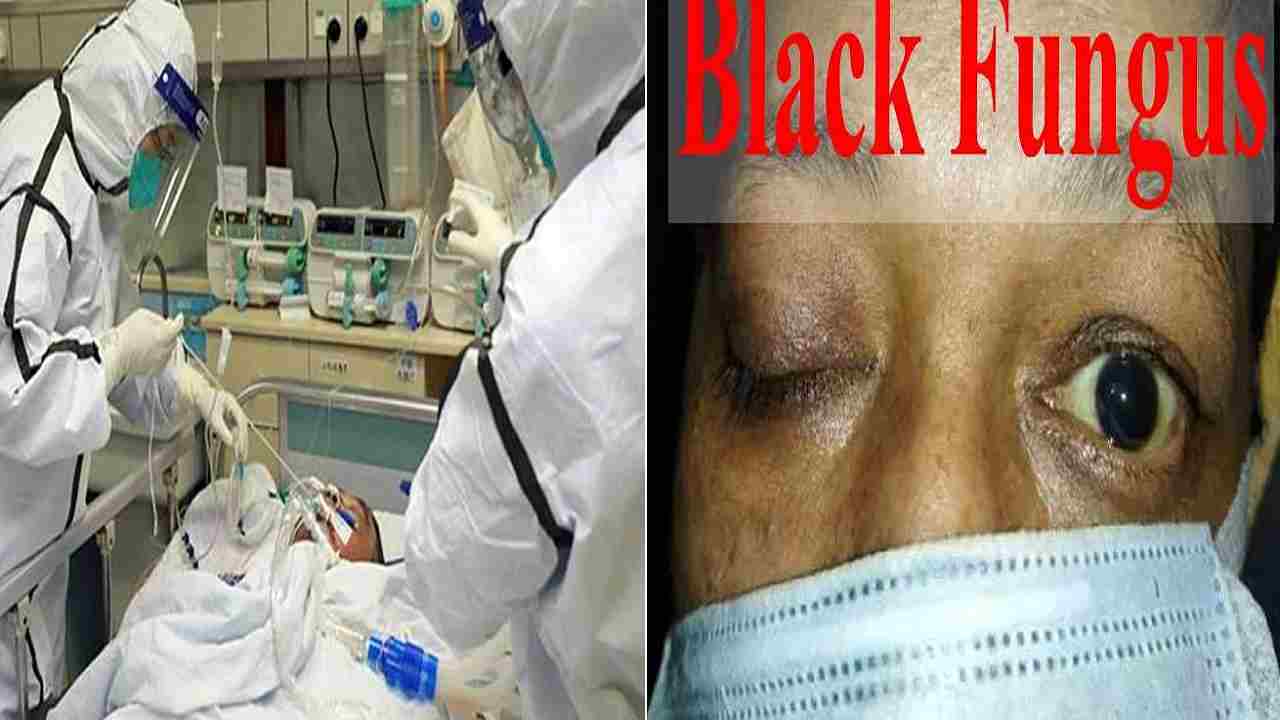 Black Fungus से Rewa में 1 और मरीज की मौत, अब तक मिले 30 मरीज