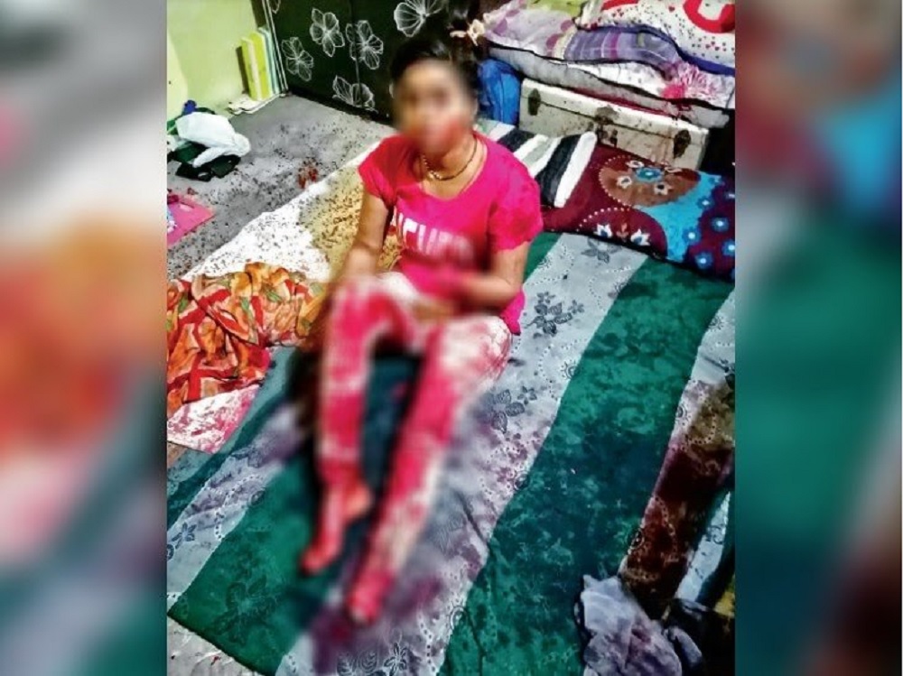 पति ने चरित्र संदेह में पत्नी की फरसे से बायां हाथ और बायां पैर काट डाला, फोटो देख रो देंगे आप: MP NEWS