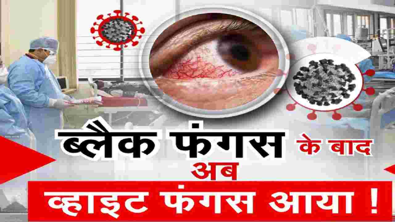 Black Fungus के बाद White Fungus ने मचाई तबाही, किडनी, ब्रेन, प्राइवेट पार्ट्स सहित इन जगह फैला रहा संक्रमण Black Fungus के बाद White Fungus ने मचाई तबाही, किडनी, ब्रेन, प्राइवेट पार्ट्स सहित इन जगह फैला रहा संक्रमण