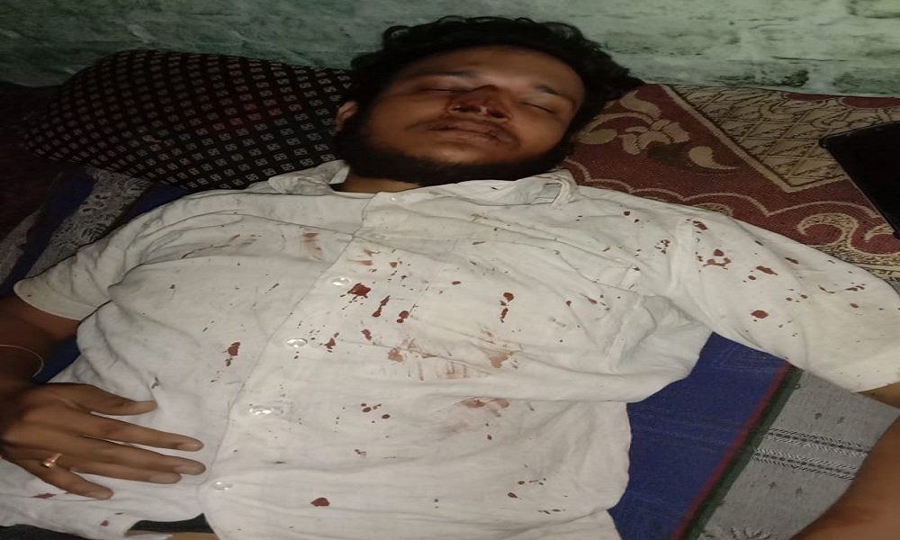 युवक पर प्राणघातक हमला, हालत गंभीर, सेमरिया थाना का मामला : REWA NEWS
