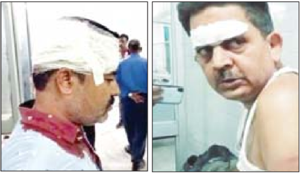 रीवा में बेख़ौफ़ हुए अपराधी, दिनदहाड़े शिक्षक और उनके साथी पर जानलेवा हमला : REWA NEWS रीवा में बेख़ौफ़ हुए अपराधी, दिनदहाड़े शिक्षक और उनके साथी पर जानलेवा हमला : REWA NEWS