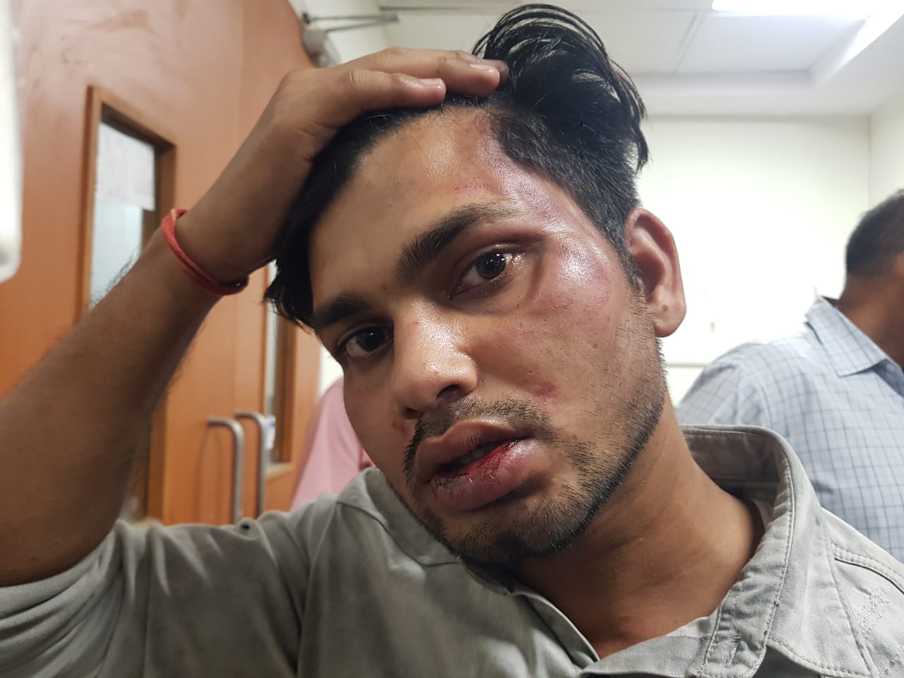 REWA : डाक्टर सिर्फ दवाई नहीं करता बल्कि पिटाई भी करता है, सीआईएसएफ जवान को धुना REWA : डाक्टर सिर्फ दवाई नहीं करता बल्कि पिटाई भी करता है, सीआईएसएफ जवान को धुना